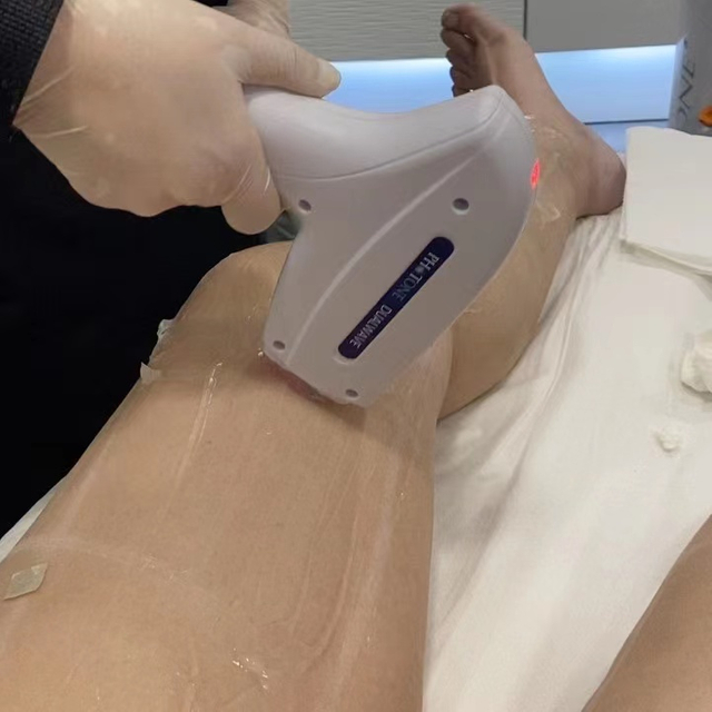 Dispositivo de terapia con l&aacute;ser de diodo